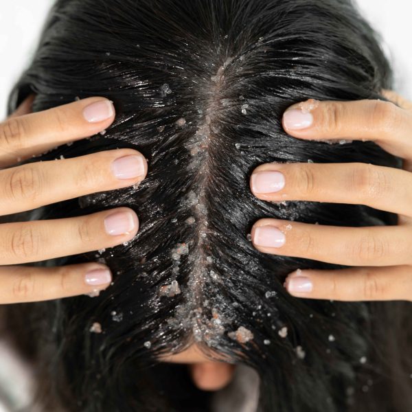 Pink Salt Scalp Scrub - Exfoliates & Revitalises - Image 5